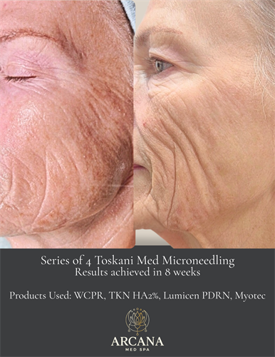 Gallery Image 31278.png