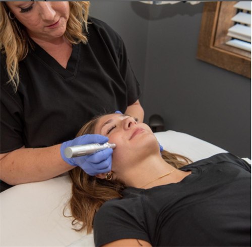 If you are looking for a great way to reduce acne scarring, wrinkles, and give your skin a completely rejuvenated look, give our team a call at Local Luxury Med Spa. With microneedling, you’ll have a plump, rosy, and luminous look for weeks. You’ll get a boost of collagen and elastin after your treatment for continuously healthy looking skin.