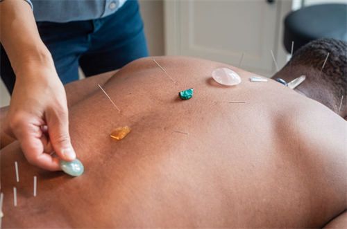 Acupuncture with crystal therapy.