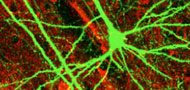 Gallery Image brainmap-neuron-1-190x90.jpg