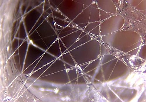 What is Fascia? The fascinating web that connects every cell inside of us!