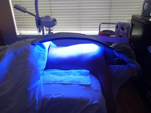 LED Light Therapy for acne
