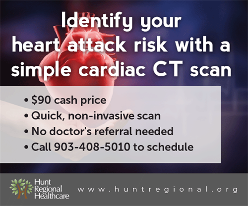 Cardiac CT Scan