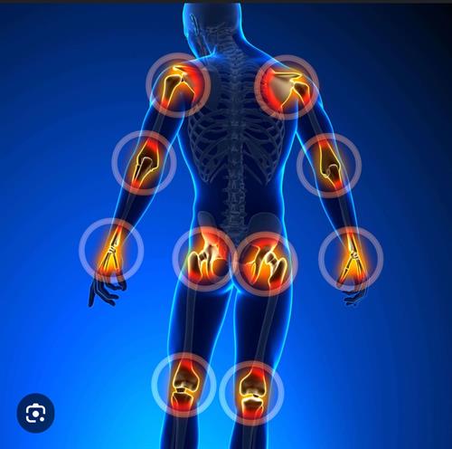 Gallery Image StemWave_joint_pain_images.JPEG