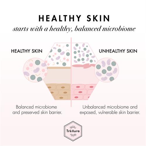 Hralthy skin requires healthy microbiome