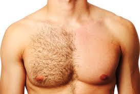 Chest Waxing