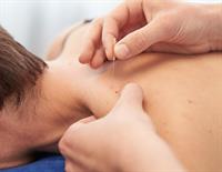 Free Dry Needling Day