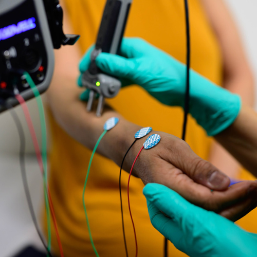 Nurse practitioner performing EMG electrodiagnostic testing at MIND.