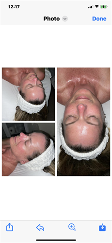 Anti-Aging facial with Stem cells & LED Red Light Therapy 