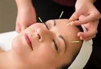 Yahara River Acupuncture & Chinese Herbal Medicine - Stoughton