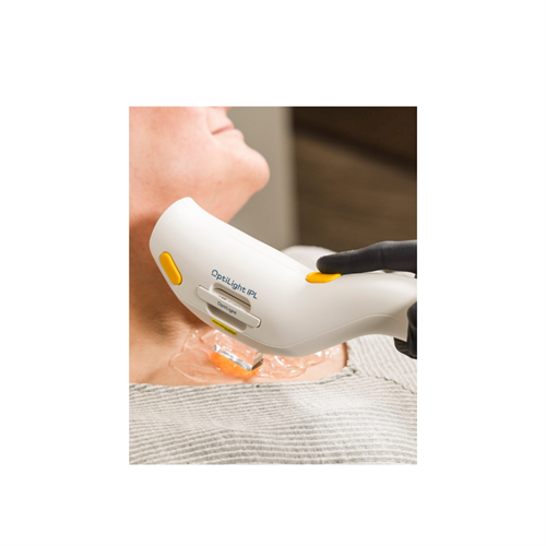 Optilight treatment