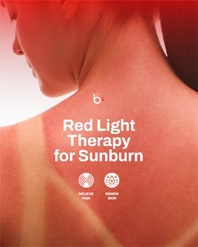 Gallery Image Red_Light_For_Sunburn_3_-_Social_Story.png