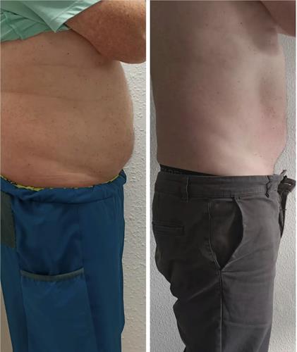 Neveskin Slimming Men