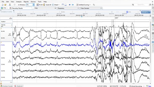 Sleep Test Data