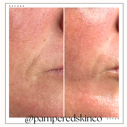 1hour after xXPeel5 1hour after xXPeel5