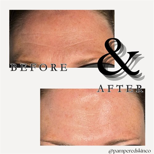 XPeel5 Magic ?? XPeel5 Magic ??