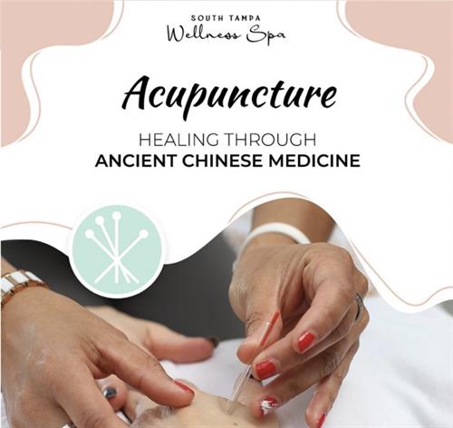 Acupuncture treats a variety of ailments including nausea, migraines, chronic pain, and infertility!