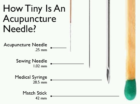 How big is an acupuncture needle?!