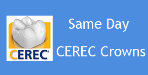 Gallery Image CEREC-Same-day-crowns_3.png