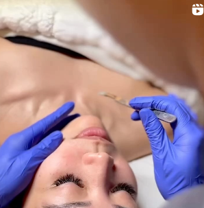 Facials Facials