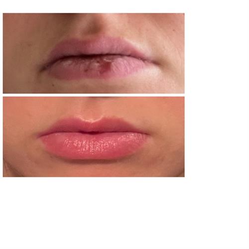 Lip Treatment- DiamonGlow Lip Treatment- DiamonGlow