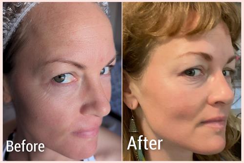 Fine Lines & wrinkles improved plus enhanced Glow after just 1 BB Glow Semi Permanent Foundation Treatment