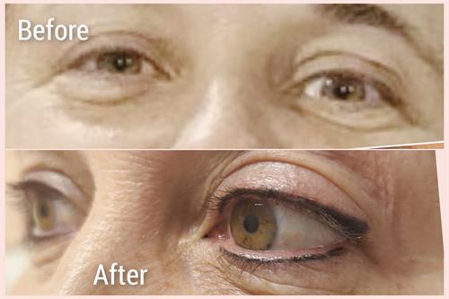 Classic Eyeliner Tattoo gives enhanced definition and a more youthful, wide awake look