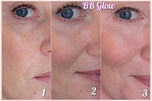 Results of brighter and more even skin tone after 3 BB Glow semi permanent foundation treatments