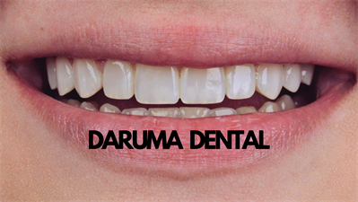 Daruma Dental