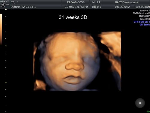 Baby at 31 weeks in 3D