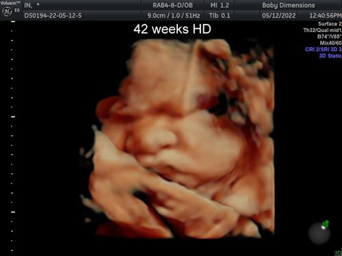 42 week Baby in HD imaging
