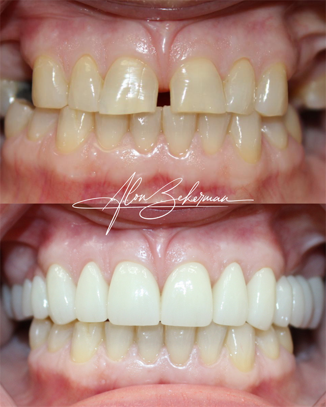 Gallery Image Updated_Before_and_Afters__(1).png