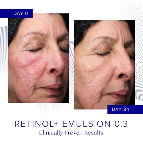 Gallery Image B_A_Retinol_results_square_2.jpg