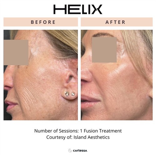 Gallery Image Helixfusionface.jpg
