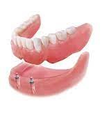 Implant Supported Denture