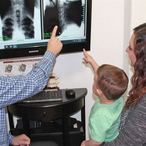 Going over x-rays with a patient