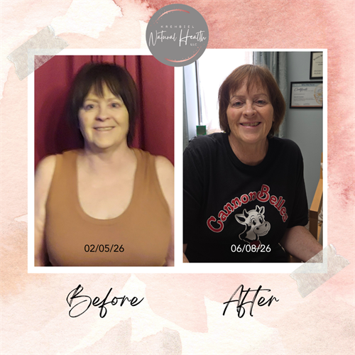 P Before and After