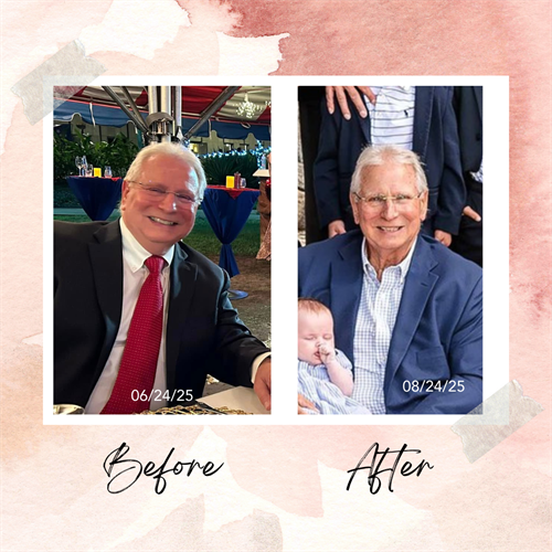 Greg Before and After