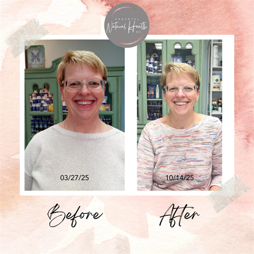 Lisa Before and After