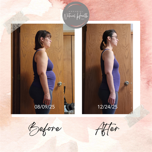 Lisa Before and After