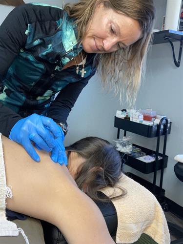Dry Needling