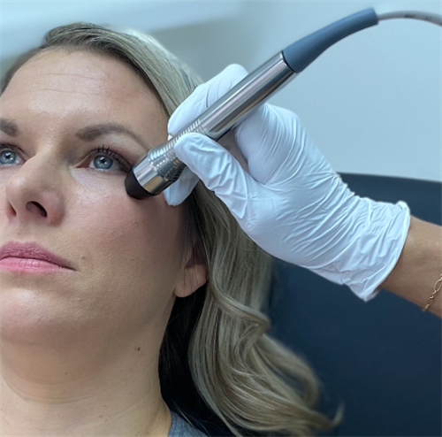 Forma I- a cutting edge treatment for dry eye in Santa Monica