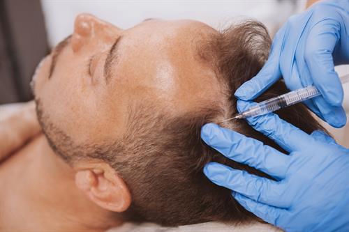 We use Platelet Rich Plasma with Hair Restoration and Microneedling