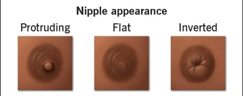 Nipples Dont look right Come see us ASAP