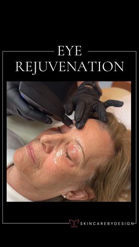 Gallery Image Botox_(2).jpg