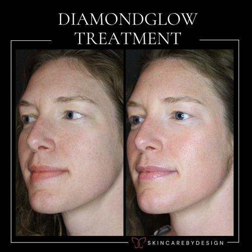 Gallery Image UNicorn_and_Dermal_filler.jpg