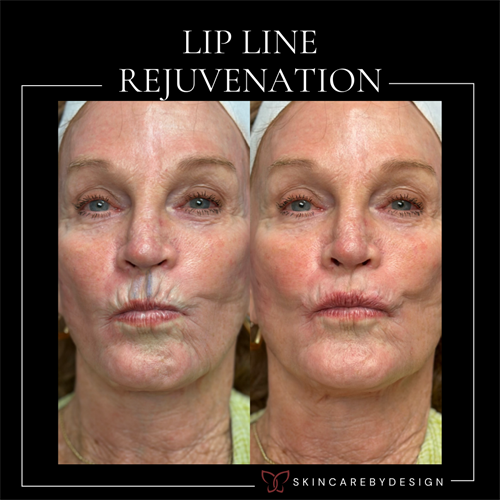 Gallery Image UNicorn_and_Dermal_filler_(4).png