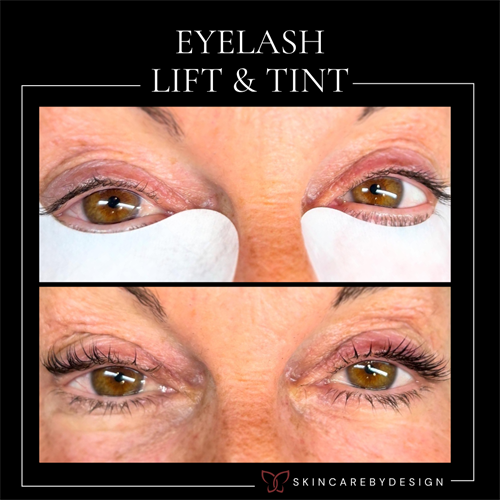 Gallery Image UNicorn_and_Dermal_filler_(5).png