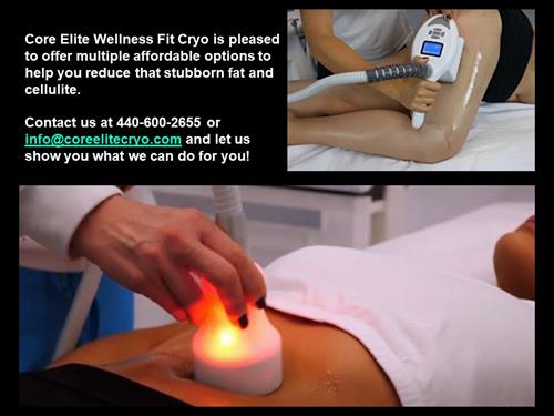 Cryo T-Shock and Zemits Bionexis for body treatments, including contouring and sculpting.