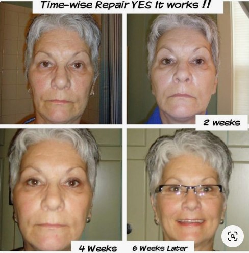 Using our Repair Volu-firm Skin care.  Look at results from 6 weeks!